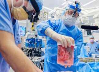 Advancements in Xenotransplantation: Gene-Edited Pig Kidney Successfully Transplanted – Latest Update advancements-in-xenotransplantation-gene-edited-pig-kidney-successfully-transplanted-latest-update