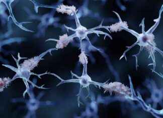 Axsome submits Alzheimer’s disease drug for FDA approval after Phase 3 trials new-title-axsome-submits-alzheimers-disease-drug-for-fda-approval-after-phase-3-trials