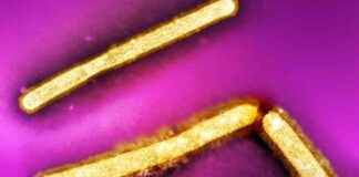 First Fatal Bird Flu Case in U.S. Raises Concerns: What You Need to Know first-fatal-bird-flu-case-in-us-raises-concerns-what-you-need-to-know