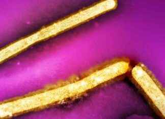 First Fatal Bird Flu Case in U.S. Raises Concerns: What You Need to Know first-fatal-bird-flu-case-in-us-raises-concerns-what-you-need-to-know