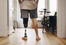 Limitation of Health Insurance Coverage for Prosthetic Limbs: Are They Medically Necessary? limitation-of-health-nsurance-coverage-for-prosthetic-limbs-are-they-medically-necessary