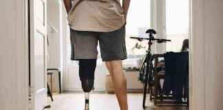 Limitation of Health Insurance Coverage for Prosthetic Limbs: Are They Medically Necessary? limitation-of-health-nsurance-coverage-for-prosthetic-limbs-are-they-medically-necessary