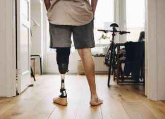Limitation of Health Insurance Coverage for Prosthetic Limbs: Are They Medically Necessary? limitation-of-health-nsurance-coverage-for-prosthetic-limbs-are-they-medically-necessary