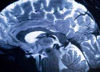 Neumora’s Antidepressant Phase 3 Trial Results: What Went Wrong? neumoras-antidepressant-phase-3-trial-results-what-went-wrong
