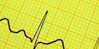 New Biotech Firm Raises $300 Million with Focus on Heart Disease new-biotech-firm-raises-300-million-with-focus-on-heart-disease