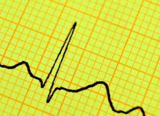 New Biotech Firm Raises $300 Million with Focus on Heart Disease new-biotech-firm-raises-300-million-with-focus-on-heart-disease