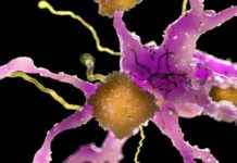 Uncovering the Dominance of the ‘Amyloid Mafia’ in Alzheimer’s uncovering-the-dominance-of-the-amyloid-mafia-in-alzheimers