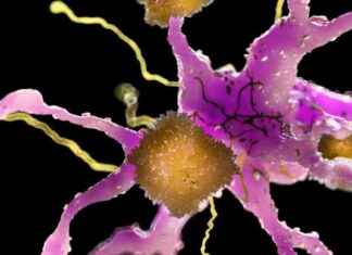 Uncovering the Dominance of the ‘Amyloid Mafia’ in Alzheimer’s uncovering-the-dominance-of-the-amyloid-mafia-in-alzheimers