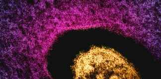 Measles Death of New Mexico Adult Under Investigation measles-death-of-new-mexico-adult-under-nvestigation