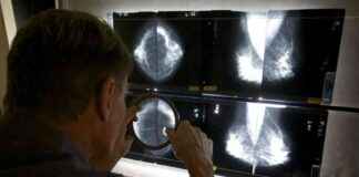 Protein Degrader in Breast Cancer Trial: Mixed Results protein-degrader-in-breast-cancer-trial-mixed-results